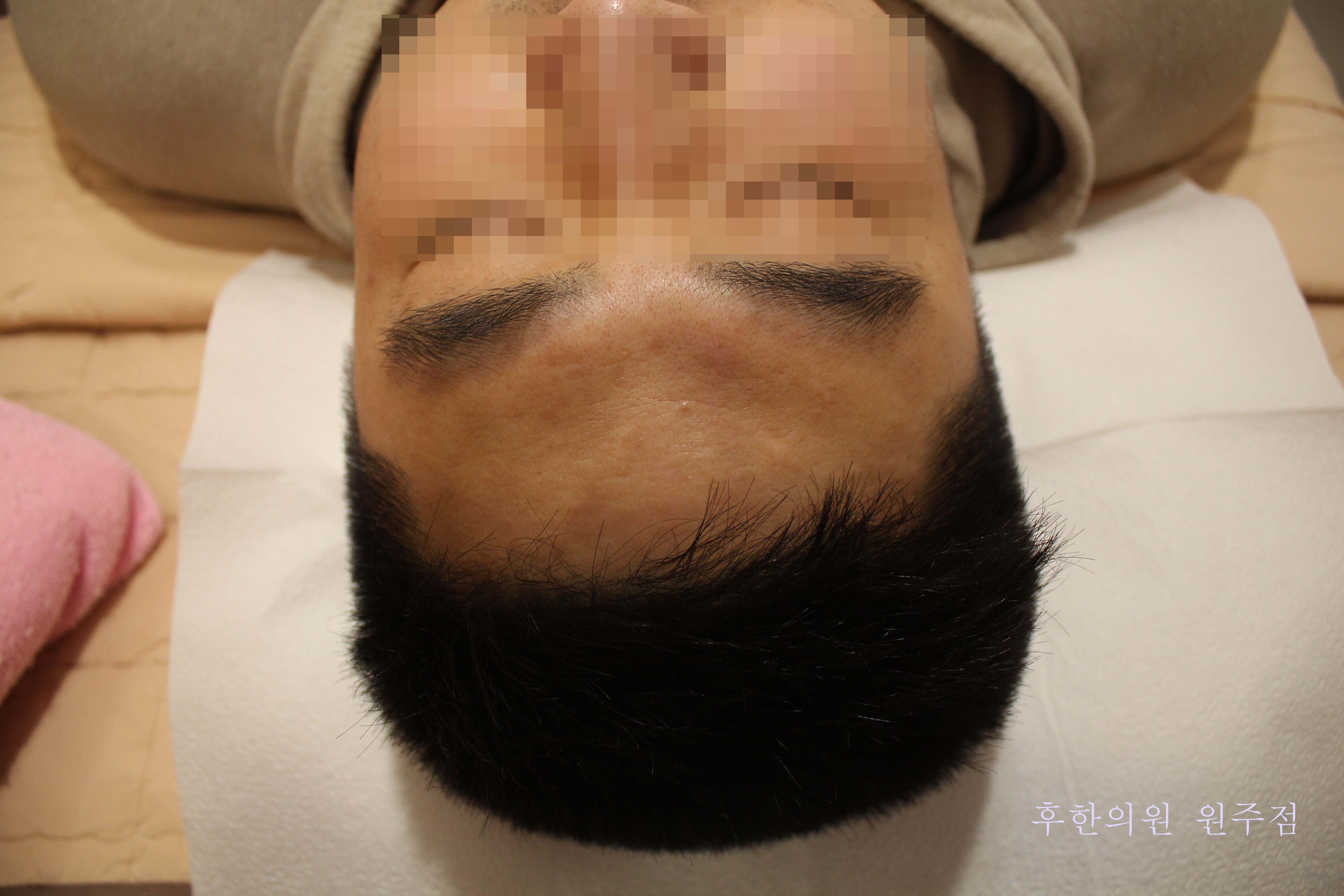 After