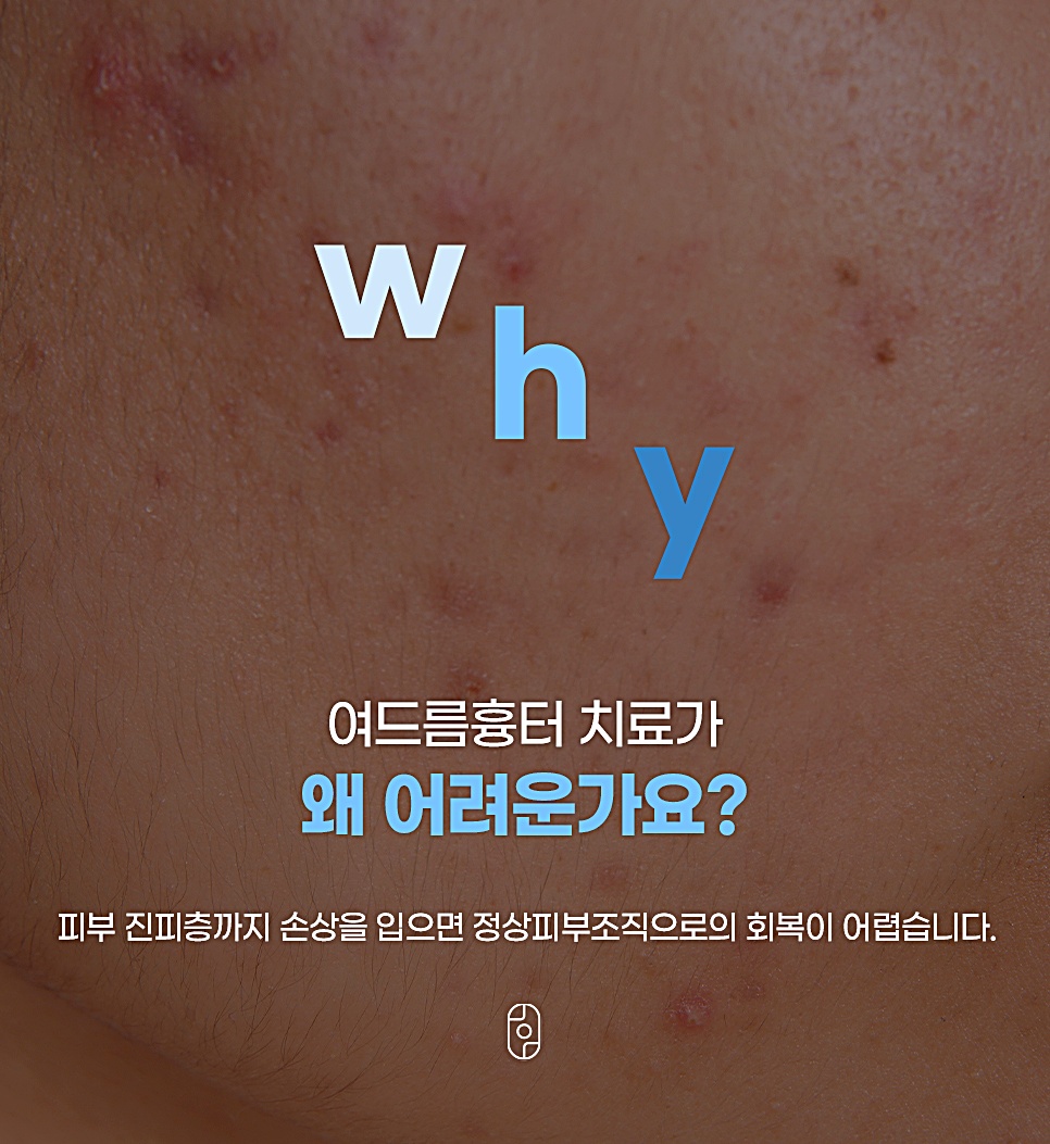 여드름흉터 치료가 왜 어려운지 설명하는 이미지, 피부 진피층까지 손상되면 정상 피부조직으로 회복 어려움