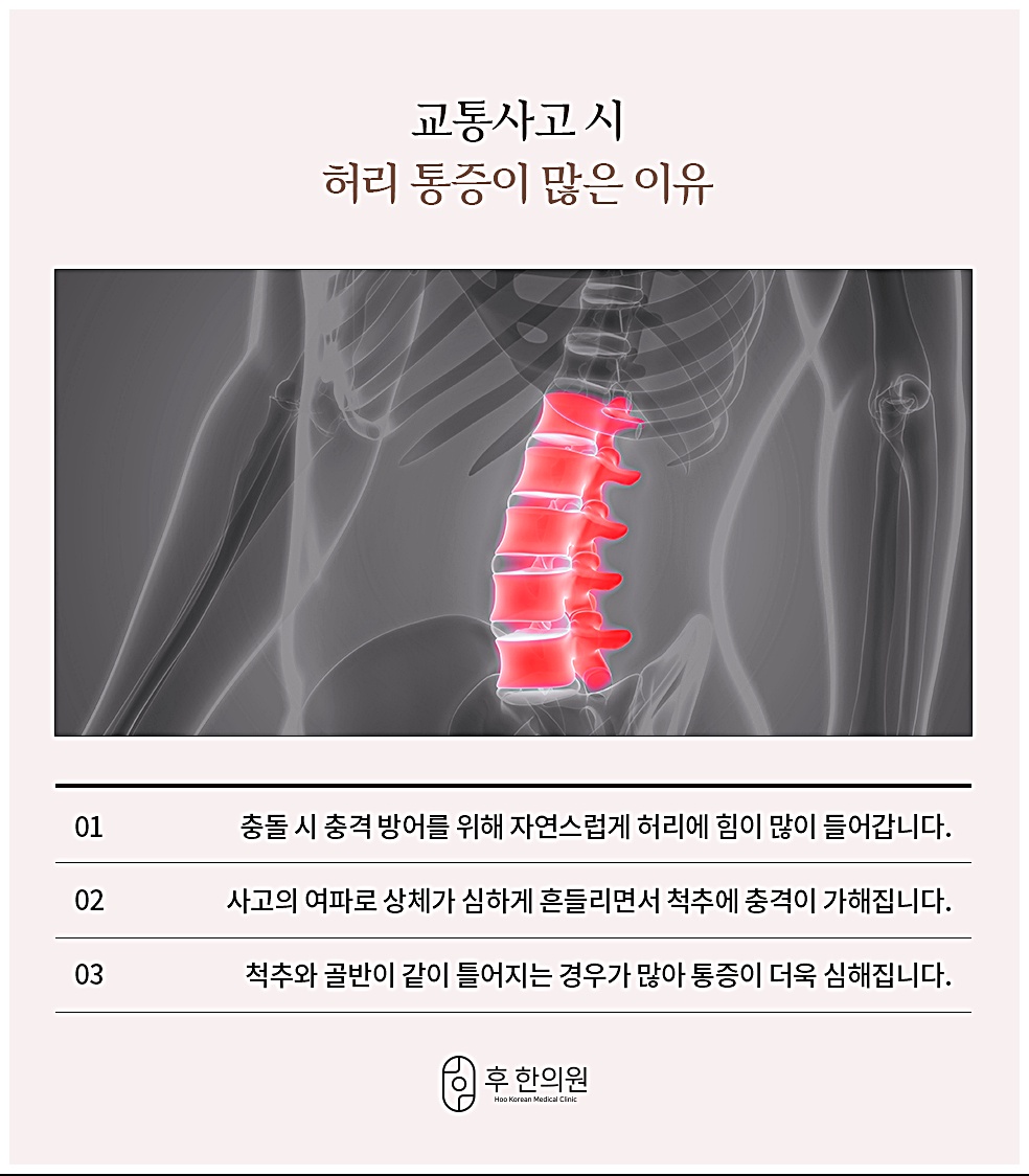 교통사고 시 허리 통증이 많은 이유 3가지