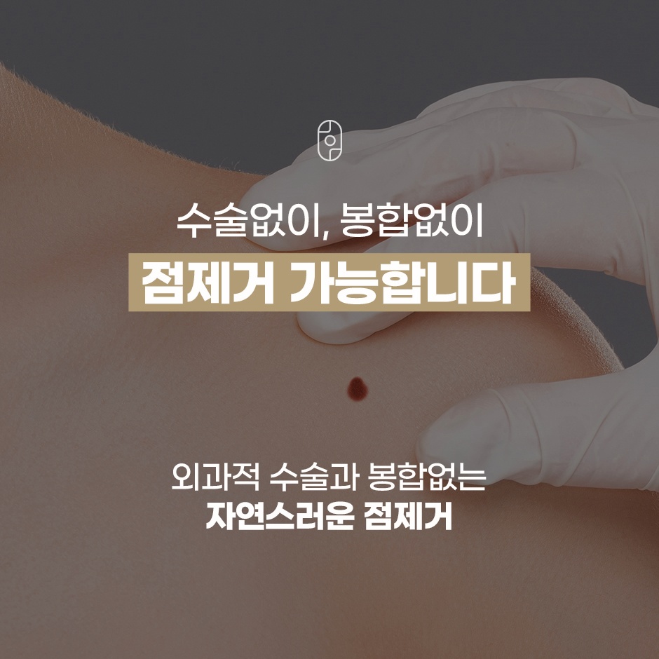 수술이나 봉합 없이 자연스럽게 진행되는 한방 점 제거 안내