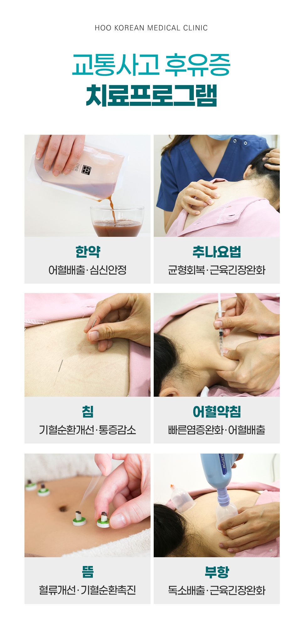 후한의원 교통사고 후유증 한방 치료 프로그램 (한약, 추나, 침, 약침, 뜸, 부항)