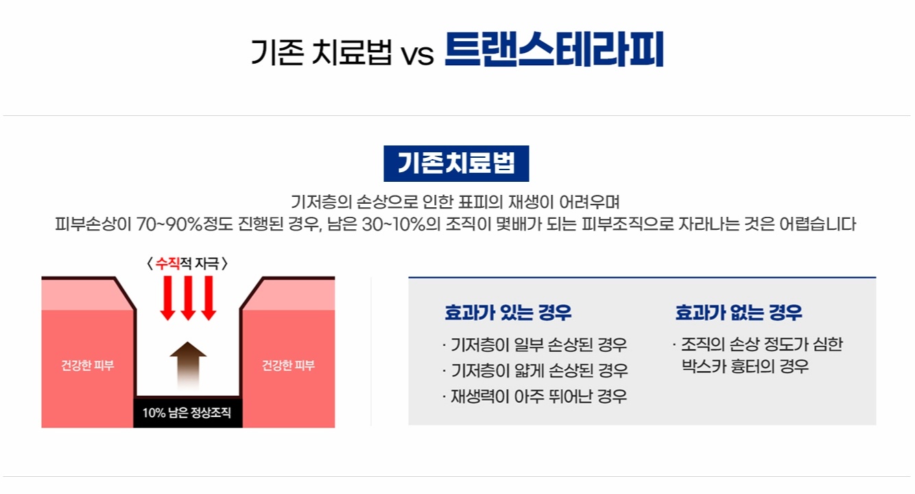 기존 흉터 치료법과 기저층 손상 원리 설명