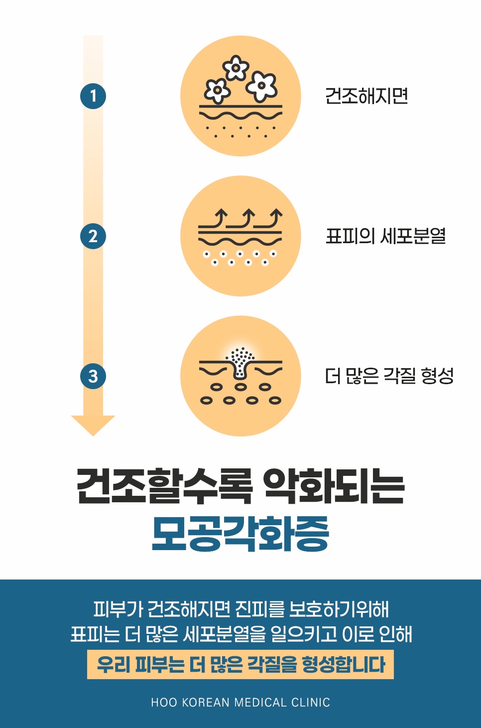 피부 건조 및 세포분열로 인한 모공각화증 악화 원인 3단계
