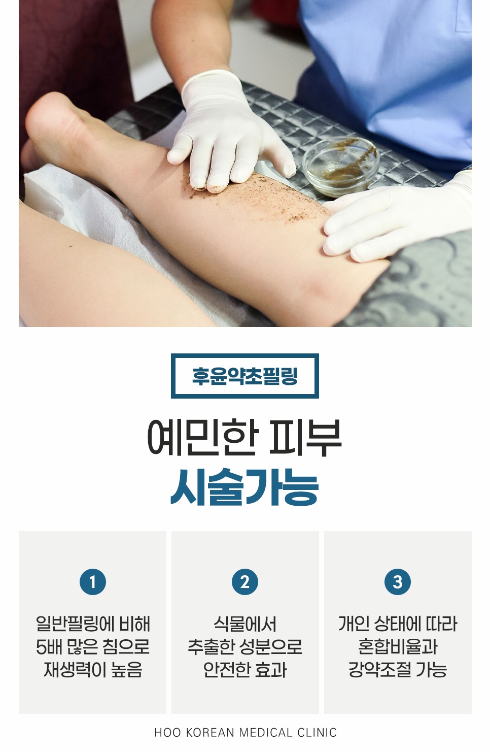 예민한 피부 모공각화증 시술 후윤약초필링 3가지 특징
