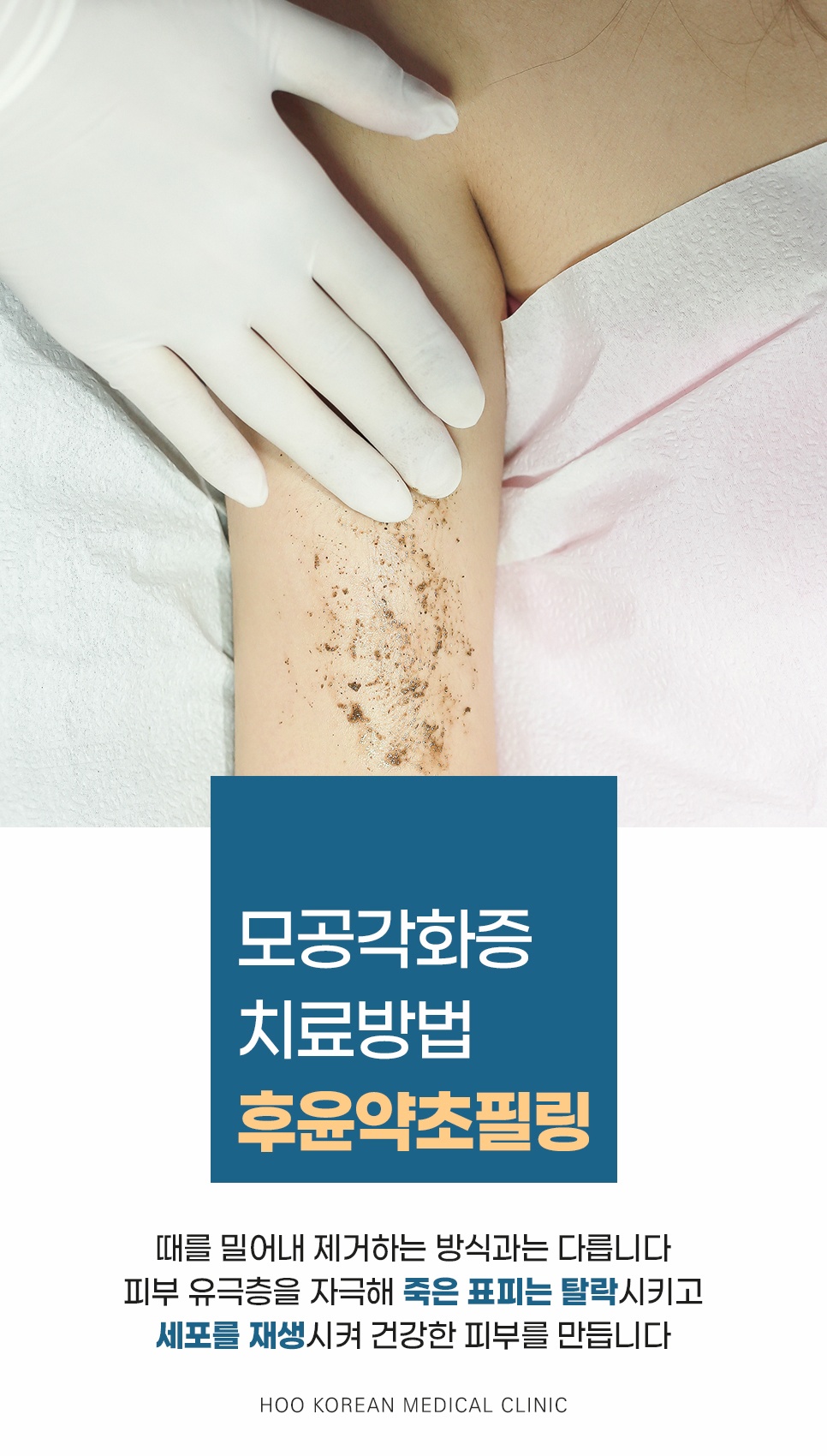후한의원 모공각화증 치료 후윤약초필링 원리 및 피부 재생 효과