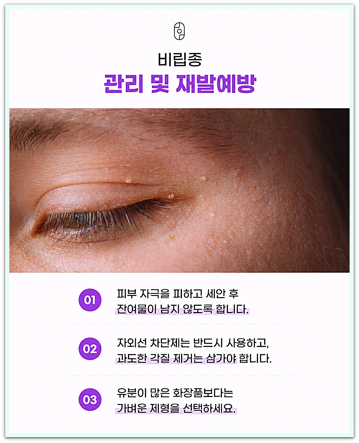 눈가 피부에 작은 비립종이 보이는 모습과 비립종 관리 및 재발예방 안내