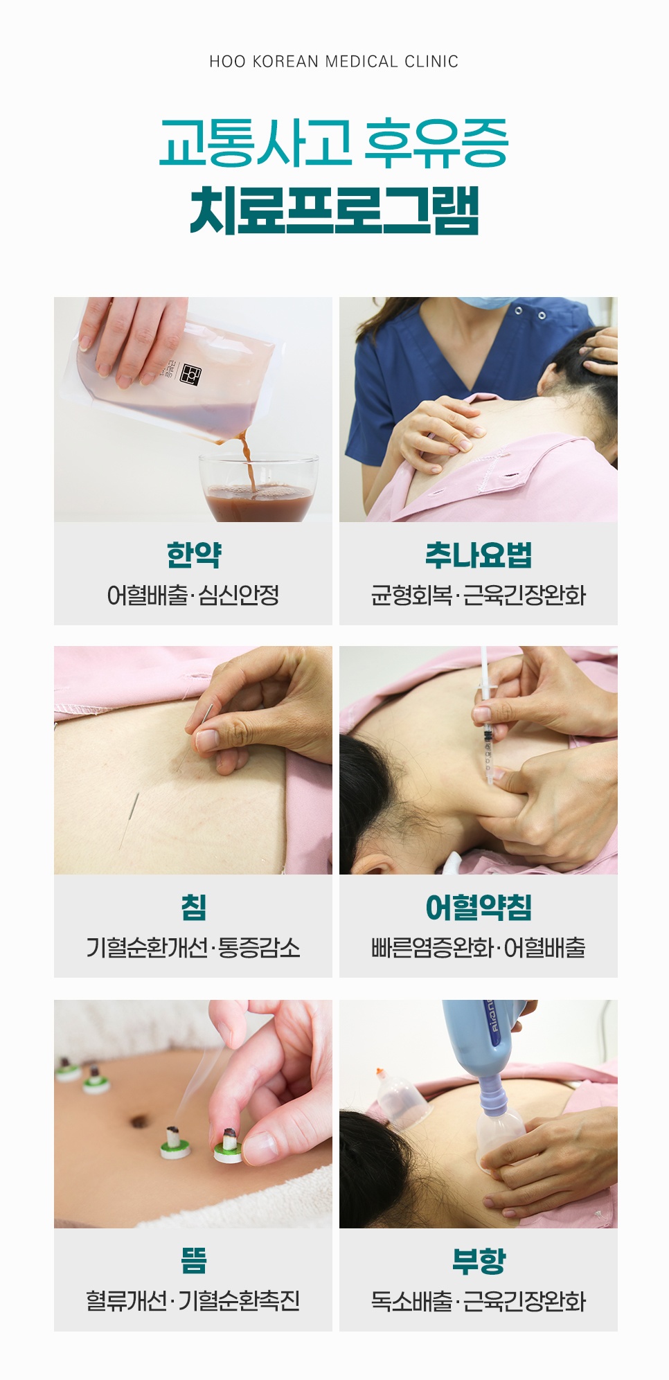 한약 따르는 모습부터 추나, 침, 어혈약침, 뜸, 부항까지 6가지 치료 사진으로 보는 후유증 치료프로그램