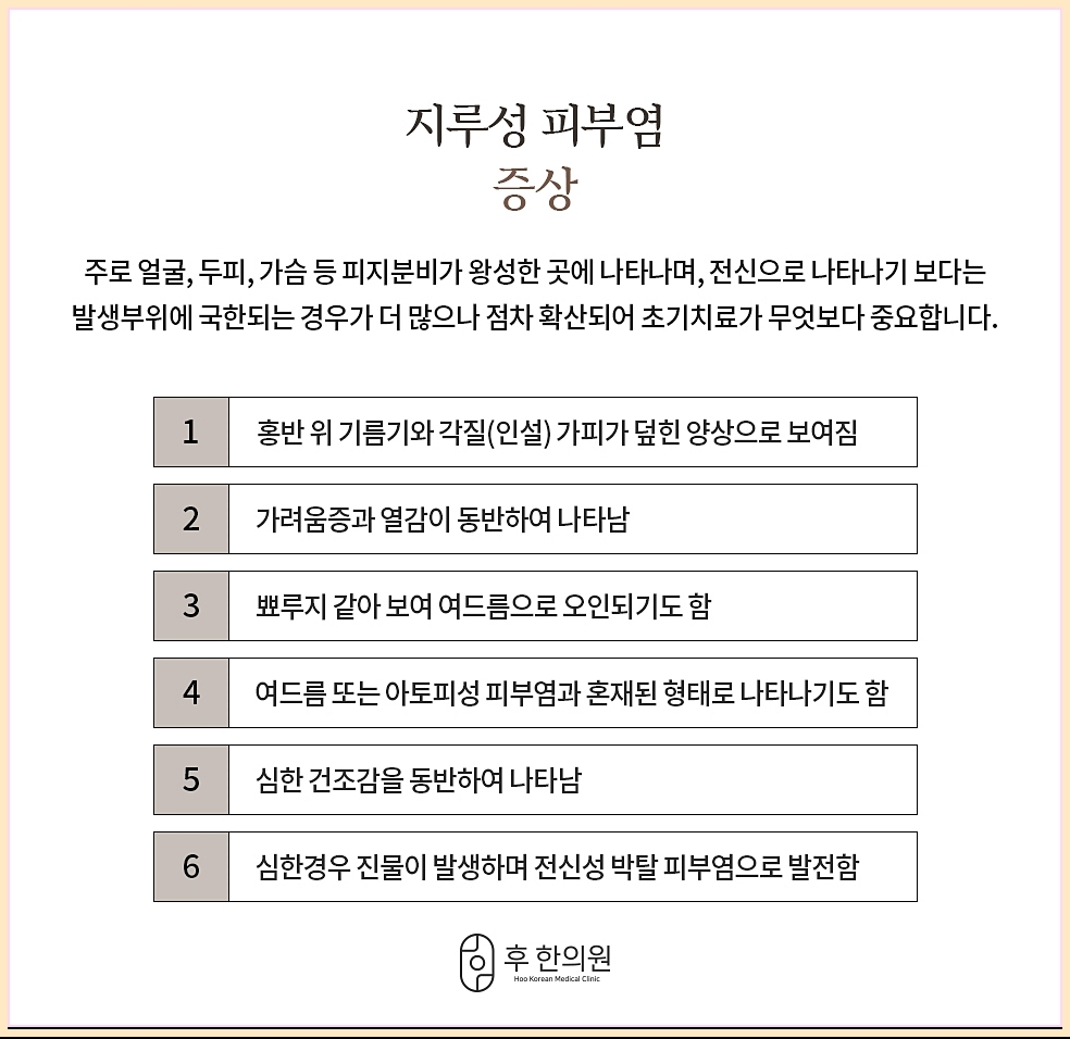 지루피부염의 다양한 증상 정리 이미지
