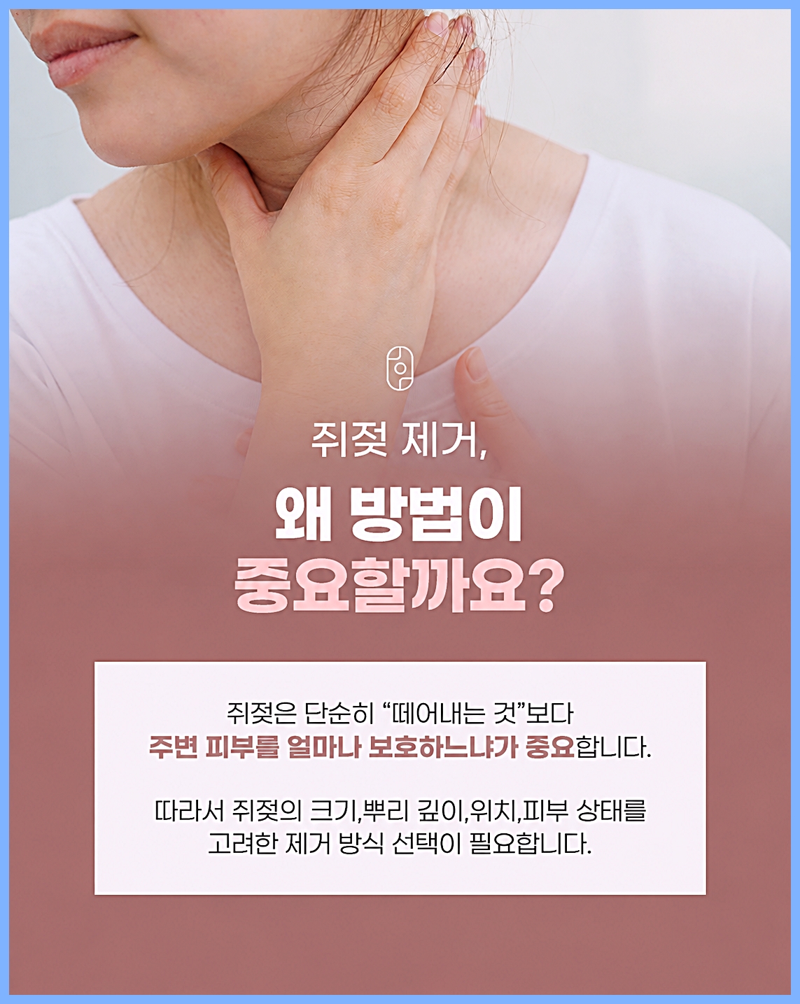 원주쥐젖 제거 방법 선택이 중요한 이유