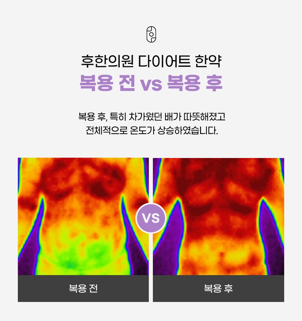 다이어트 한약 복용 전후 체열 변화