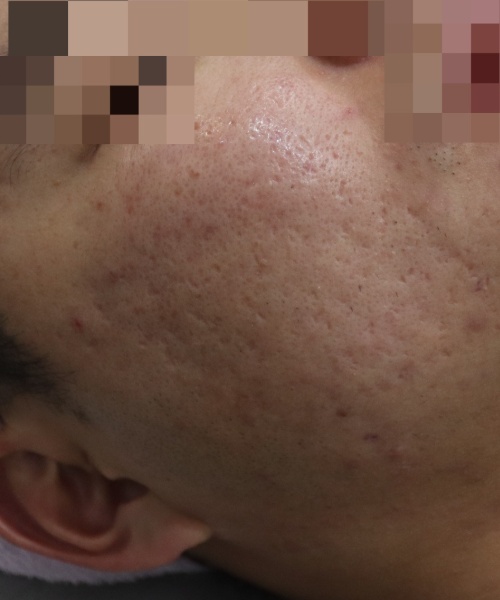 Before